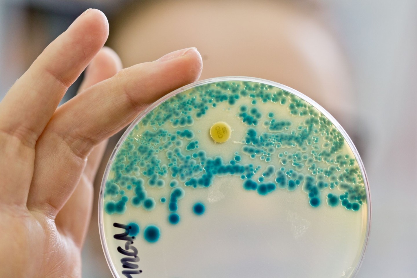 Eine Labormitarbeiterin hält eine Schale zum Nachweis von Antibiotika-resistenten Bakterien in der Hand.