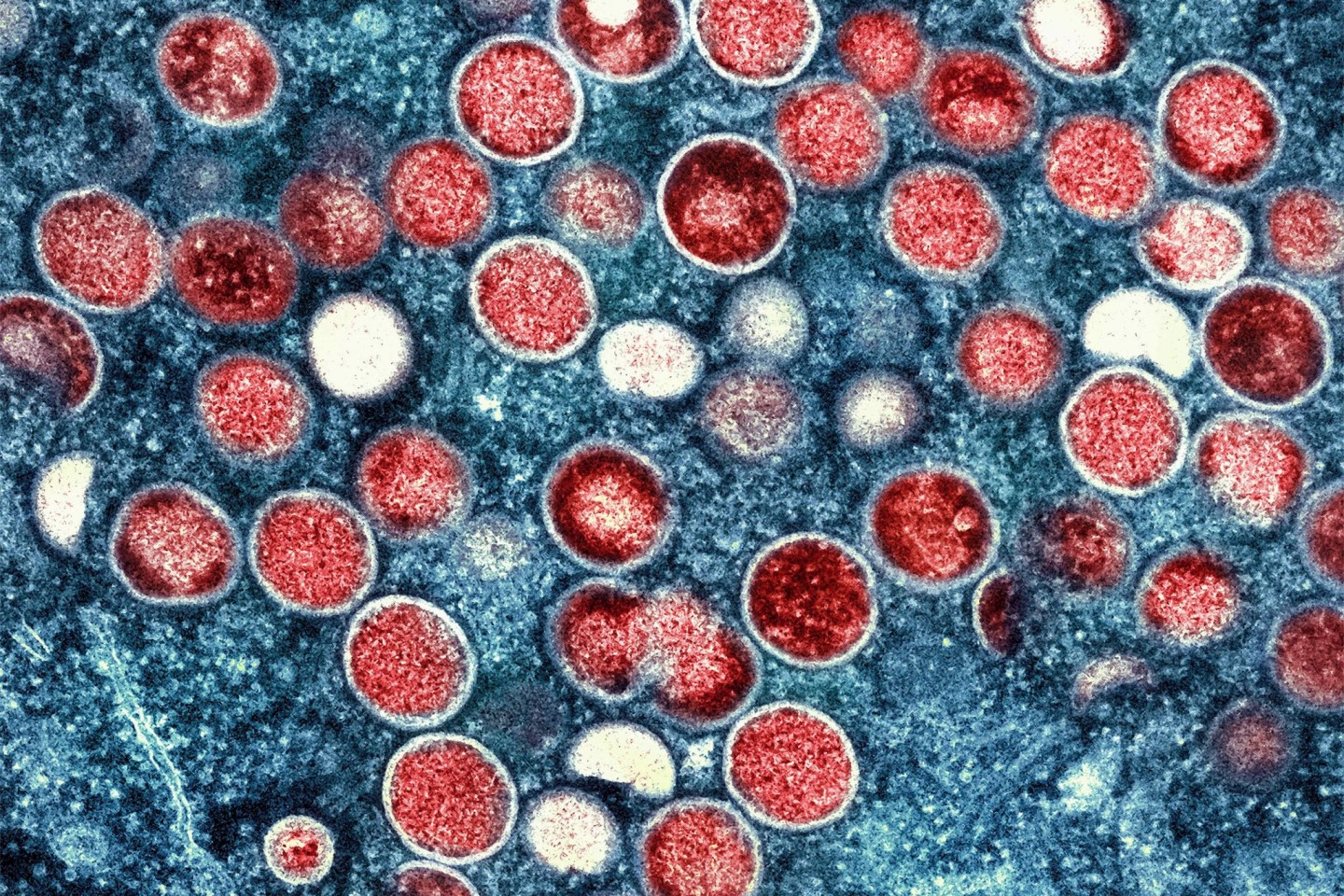 Aufnahme von Partikeln des Affenpockenvirus (rot) in einer infizierten Zelle (blau), die im Labor gezüchtet und in der NIAID Integrated Research Facility in den USA aufgenommen wurde.